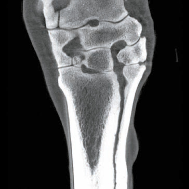 img2 radiography_edamis_1