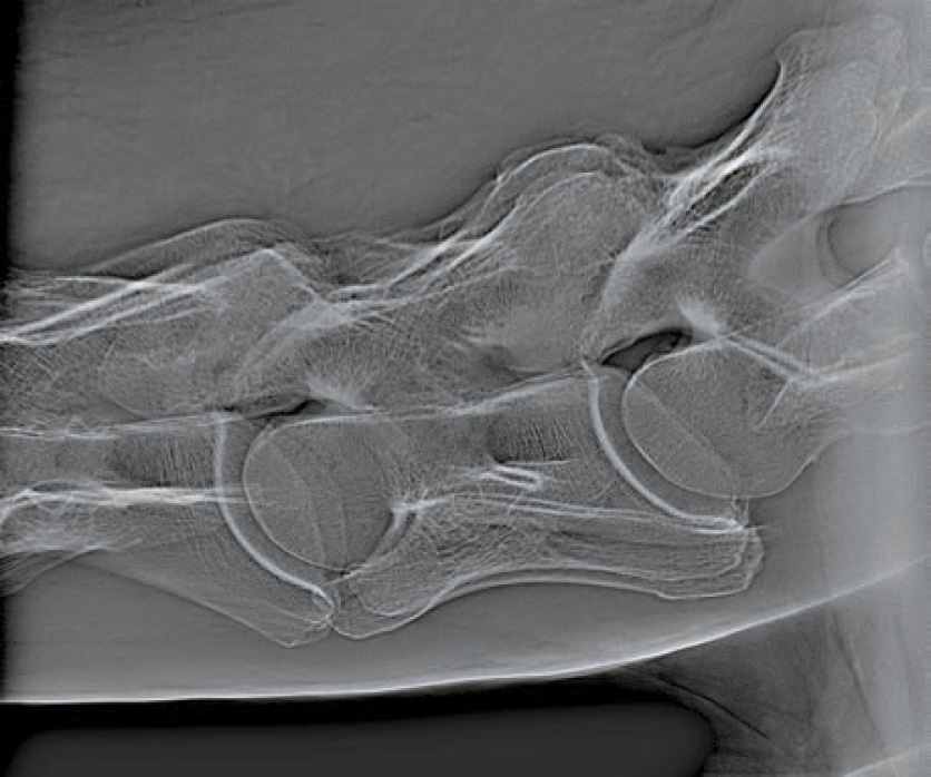 radiography_edamis_2 radiography_edamis_2